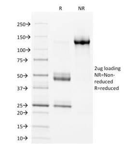HLA-DP+DQ+DR Antibody (clone CR3/43)