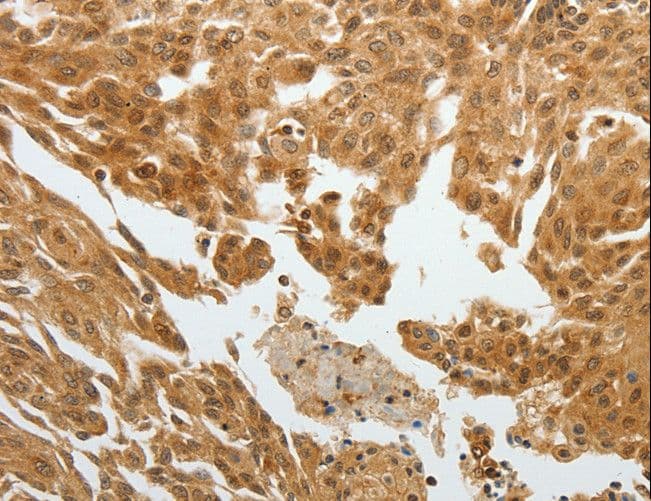 RETNLB / RELM-Beta Antibody
