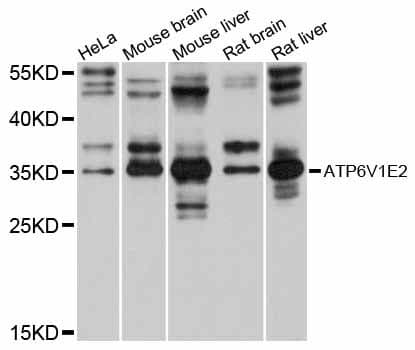 ATP6V1E2 Antibody