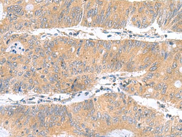DNAL1 Antibody