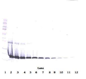 IHC-plus™ IL1RN Antibody
