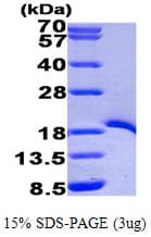 Human TRAF1 Protein (Recombinant His)