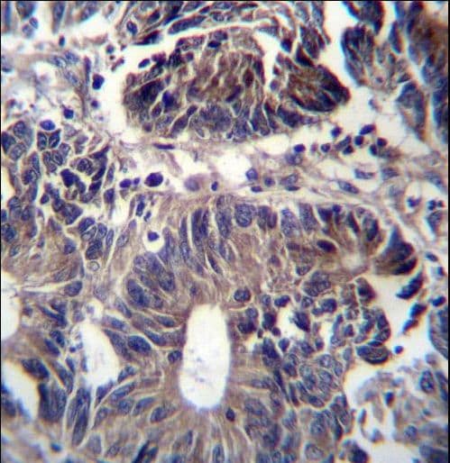 ZFYVE19 Antibody (aa387-415)