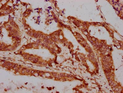 Polyclonal Rabbit anti-Human LPO / Lactoperoxidase Antibody (IHC)