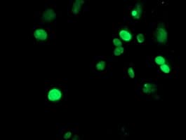 METTL16 / METT10D Antibody (clone OTI3B5)