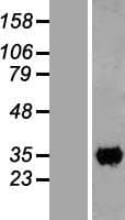 CCDC59 Protein (Over-Expression Lysate Myc-DDK (Flag))