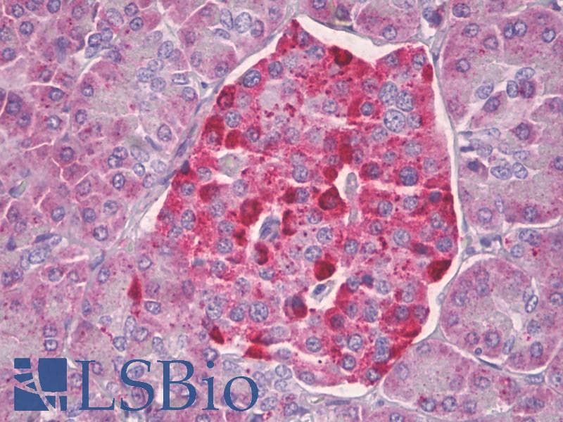 IHC-plus™ CKS2 Antibody (aa1-50)