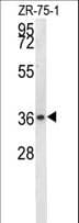 NIT1 Antibody (aa298-327)