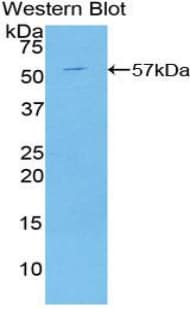 C2CD3 Antibody (aa1432-1647)