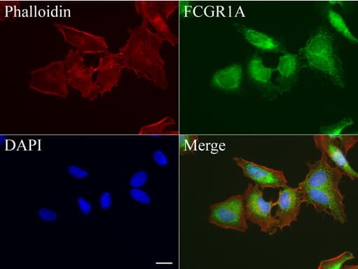 FCGR1A / CD64 Antibody (clone UMAB74, Carrier-free)