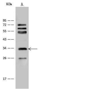 Polyclonal Rabbit anti-Human CRYM Antibody (IHC, WB)