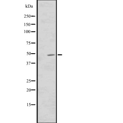 Polyclonal Rabbit anti-Human CNNM3 Antibody (IHC, WB)