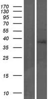 TP53INP2 Protein (Over-Expression Lysate Myc-DDK (Flag))