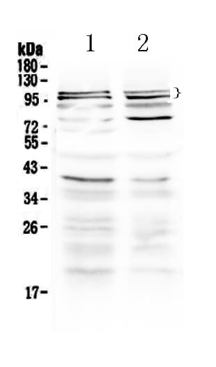Polyclonal Rabbit anti-Human TRPC3 Antibody (WB)
