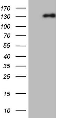 NEFM / NF-M Antibody (aa413-773, clone OTI5B7, Carrier-free)