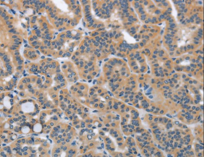 Polyclonal Rabbit anti-Human HSD3B1 Antibody (IHC, WB)