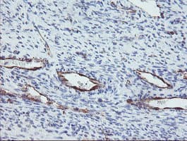 PECAM-1 / CD31 Antibody (clone OTI4C1)