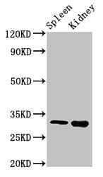 HABT1 / ABT1 Antibody