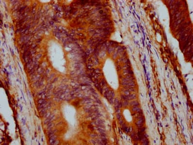 VTN / Vitronectin Antibody