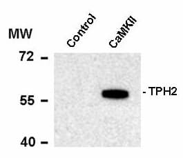 Polyclonal Rabbit anti-Rat TPH1 / Tryptophan Hydroxylase Antibody (phospho-Ser19, WB)