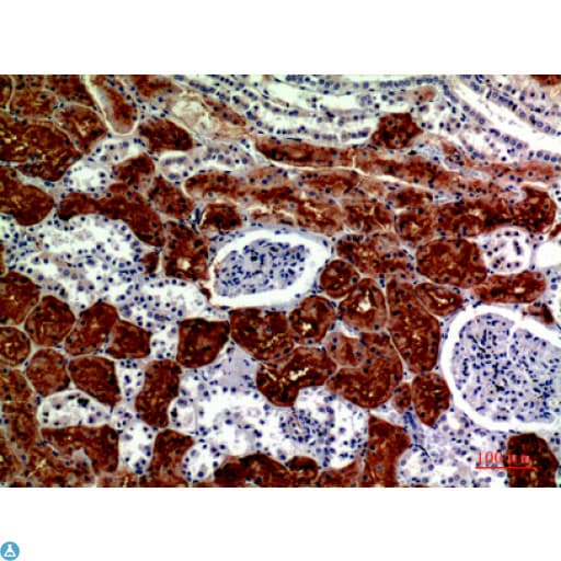 DROSHA / RNASEN Antibody