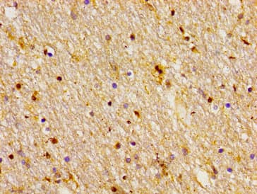 FZD10 / Frizzled 10 Antibody