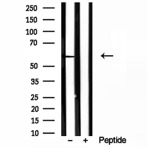 Polyclonal Rabbit anti-Human HMGCS1 / HMG-CoA Synthase 1 Antibody (IHC, IF, WB)