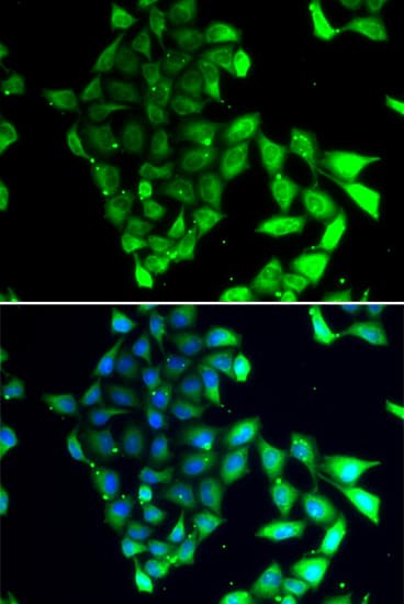 MID1 Antibody