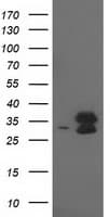 EIF4E2 / IF4e Antibody (clone OTI1F11)