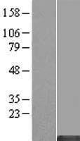 Human MT1HL1 Protein (Over-Expression Lysate Myc-DDK (Flag))