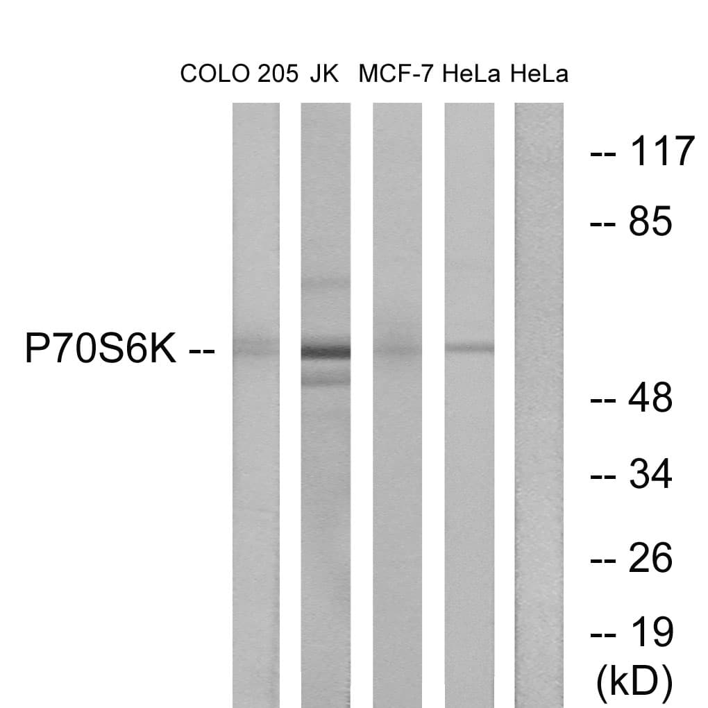 Polyclonal Rabbit anti-Human RPS6KB1 / P70S6K / S6K Antibody (aa384-433, IHC, WB)