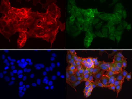 Monoclonal Mouse anti-Human KRT19 / CK19 / Cytokeratin 19 Antibody (clone UMAB187, aa240-390, IHC, IF, WB)