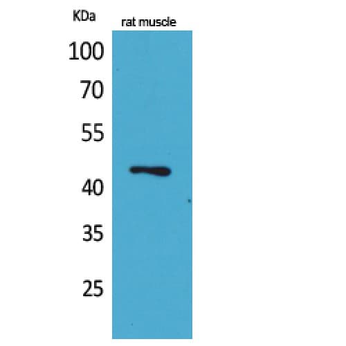 Polyclonal Rabbit anti-Human KLF12 Antibody (Internal, WB)