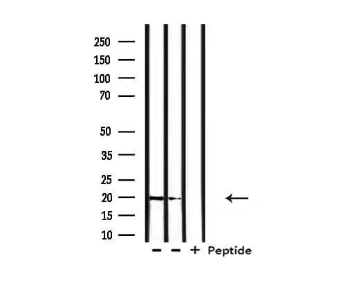 CGB / hCG Beta Antibody (aa122-148)