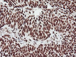 GSTT2 Antibody (clone OTI6C4)