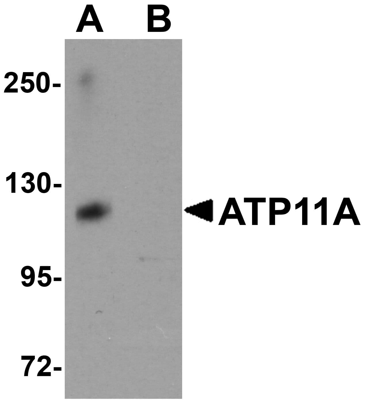 IHC-plus™ ATP11A Antibody