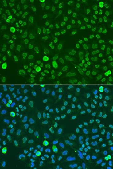 Polyclonal Rabbit anti-Human SAFB1 / SAFB Antibody (IF)