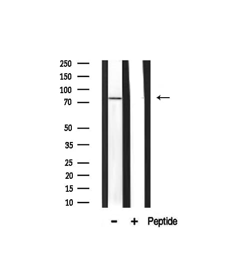 AKAP10 Antibody