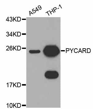 PYCARD / ASC / TMS1 Antibody