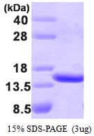 Human TBCA Protein (Recombinant)