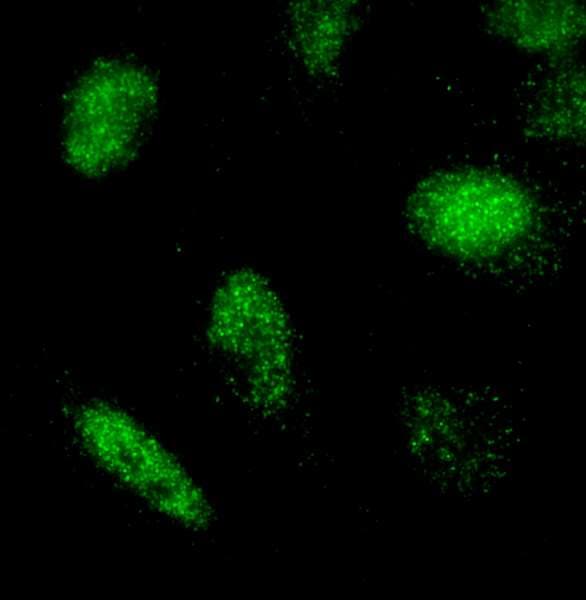 RCOR3 Antibody (aa445-495)