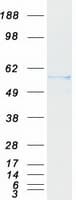 Human RALDH2 / ALDH1A2 Protein (Recombinant Myc-DDK (Flag))