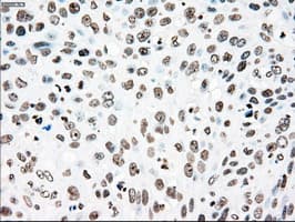 PLK1 / PLK-1 Antibody (clone OTI1D4)
