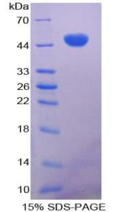 Mouse CD28 Protein (Recombinant His, N-Terminal)