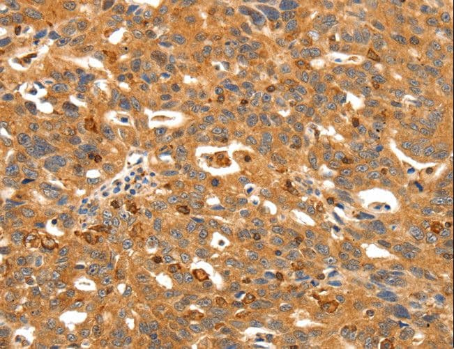 Polyclonal Rabbit anti-Human SSTR3 Antibody (IHC)