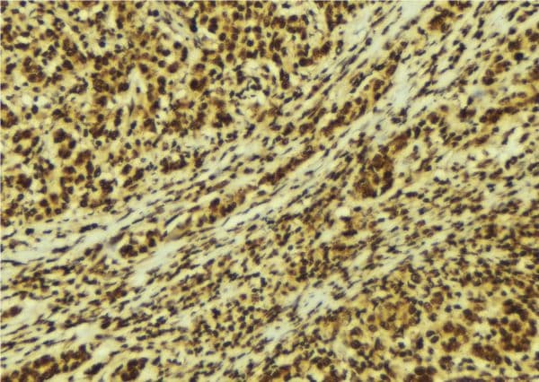 PRKCD / PKC-Delta Antibody