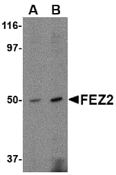IHC-plus™ FEZ2 Antibody