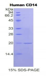Human CD14 Protein (Recombinant His)