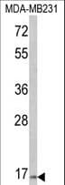 TSHB / TSH-Beta Antibody (aa58-86)