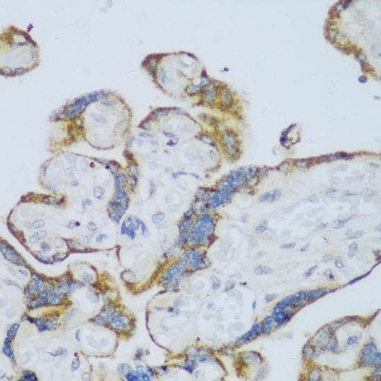 P450SCC / CYP11A1 Antibody